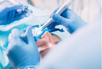 Частые вопросы пациентов об имплантации зубов