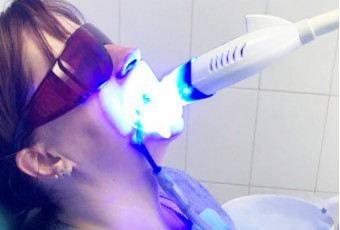 Преимущества лазерной стоматологии