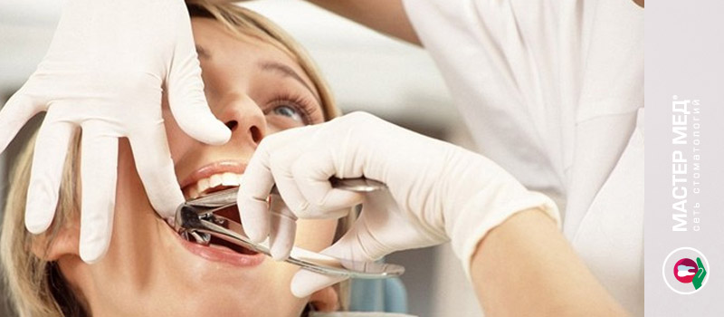 Удаление зубов мудрости в профилактических целях не рекомендуется