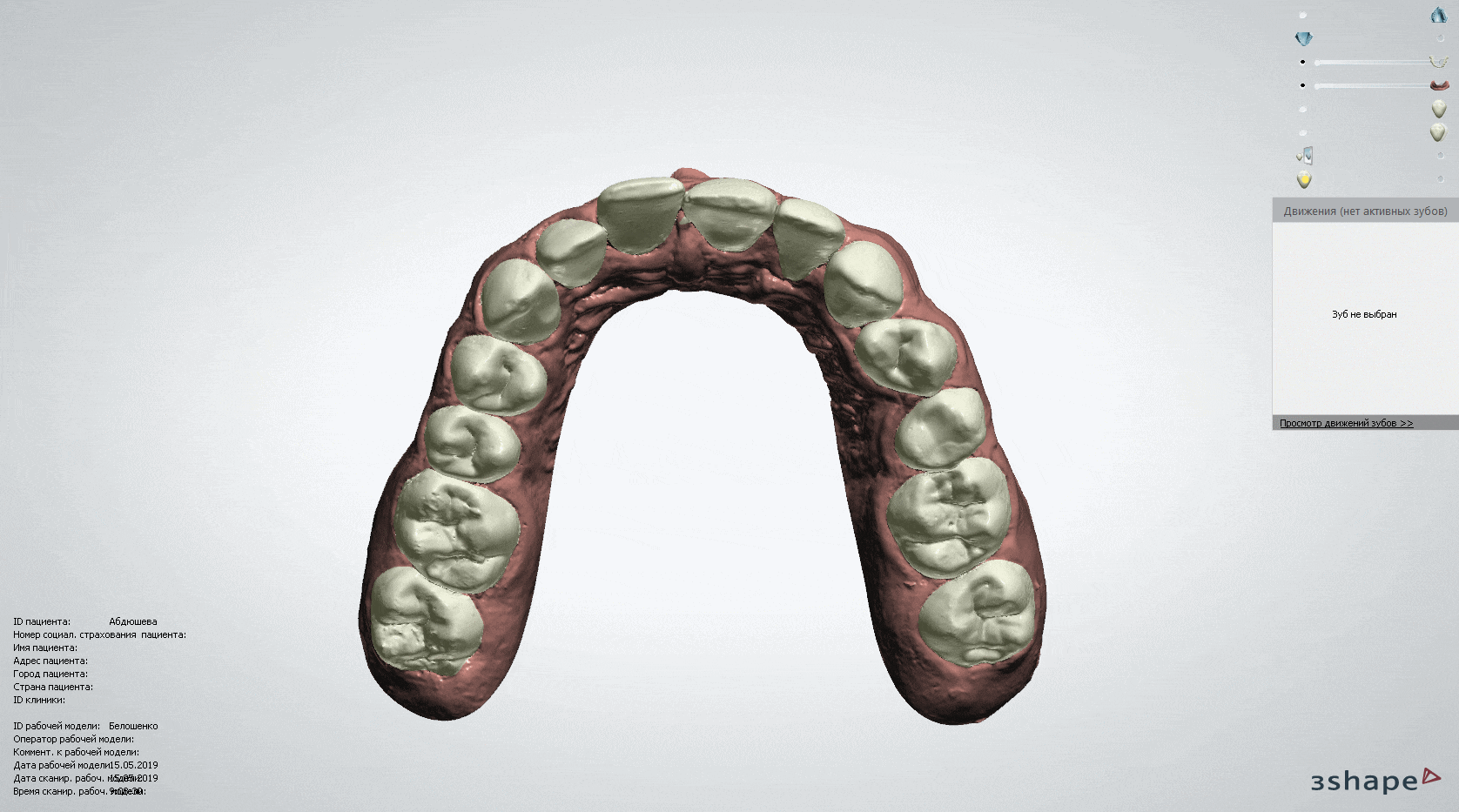 Элайнеры в Мастер Мед