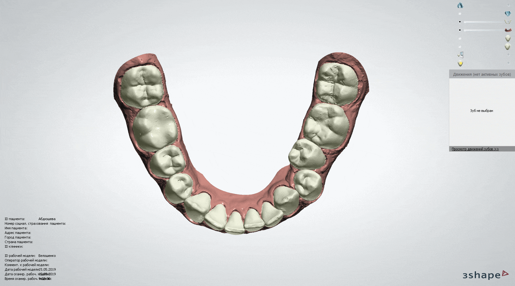 Элайнеры в Харькове