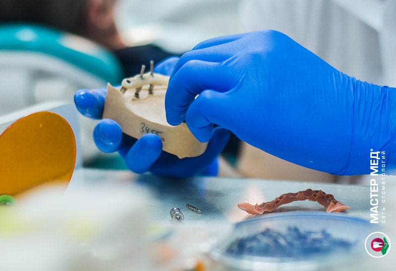 Несъемные зубные протезы