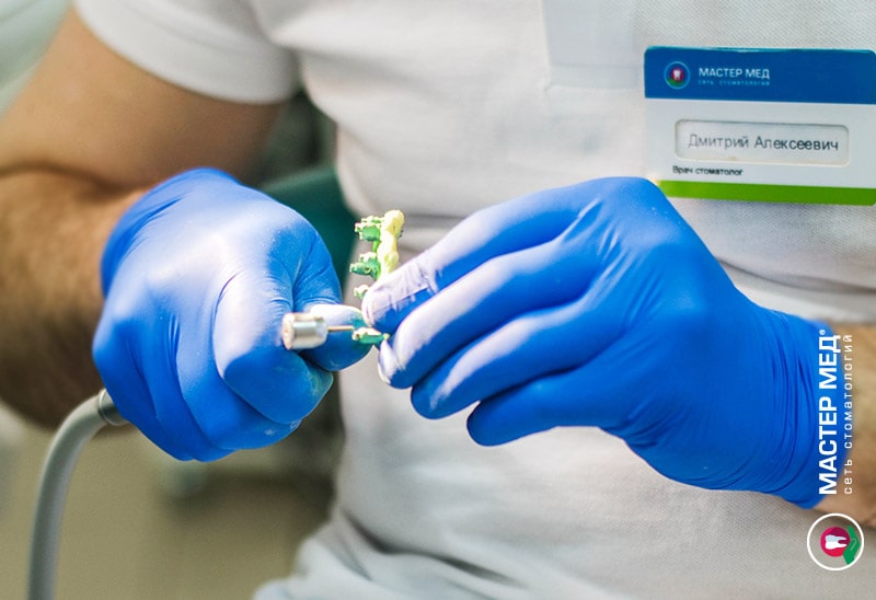 Съемные зубные протезы - при полной или частичной потере зубов